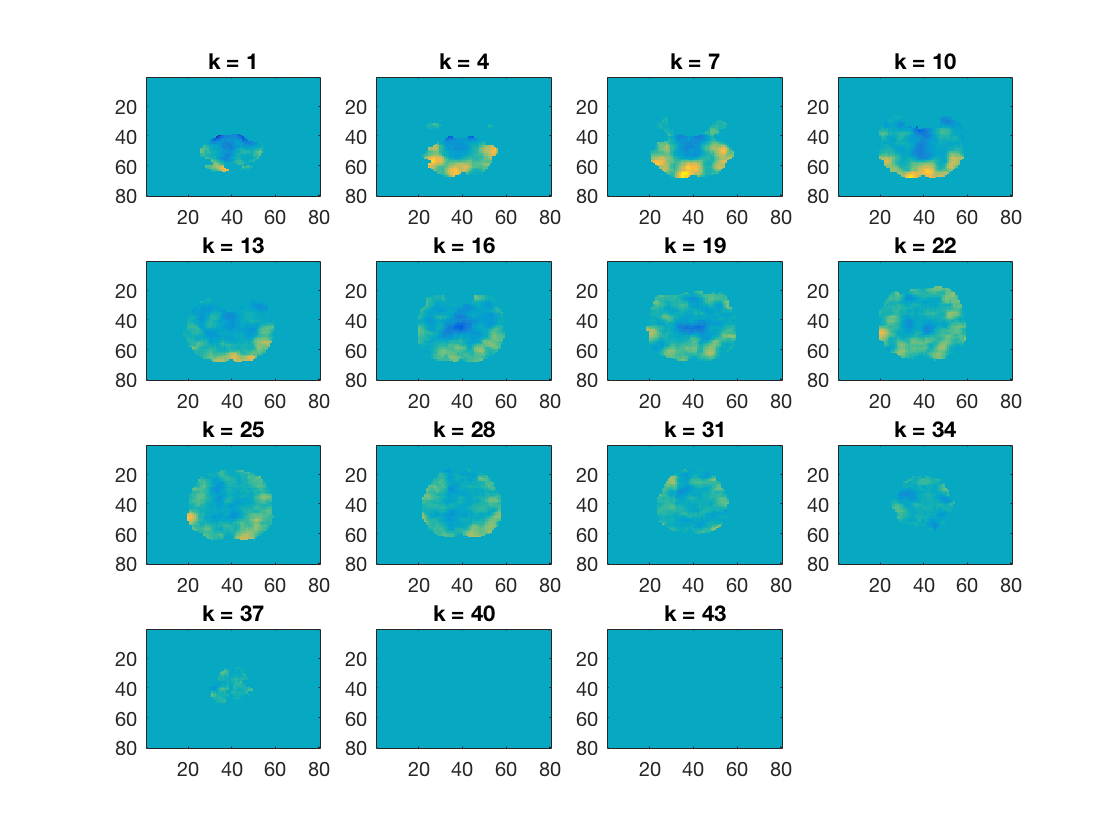 gallery_demo_fmri_correlation_searchlight_1