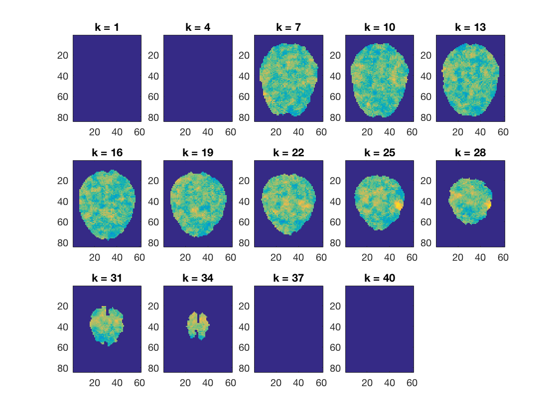 gallery_demo_fmri_searchlight_naive_bayes_1