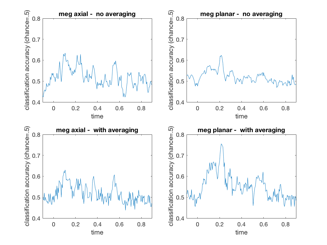 gallery_demo_meeg_timeseries_classification_1