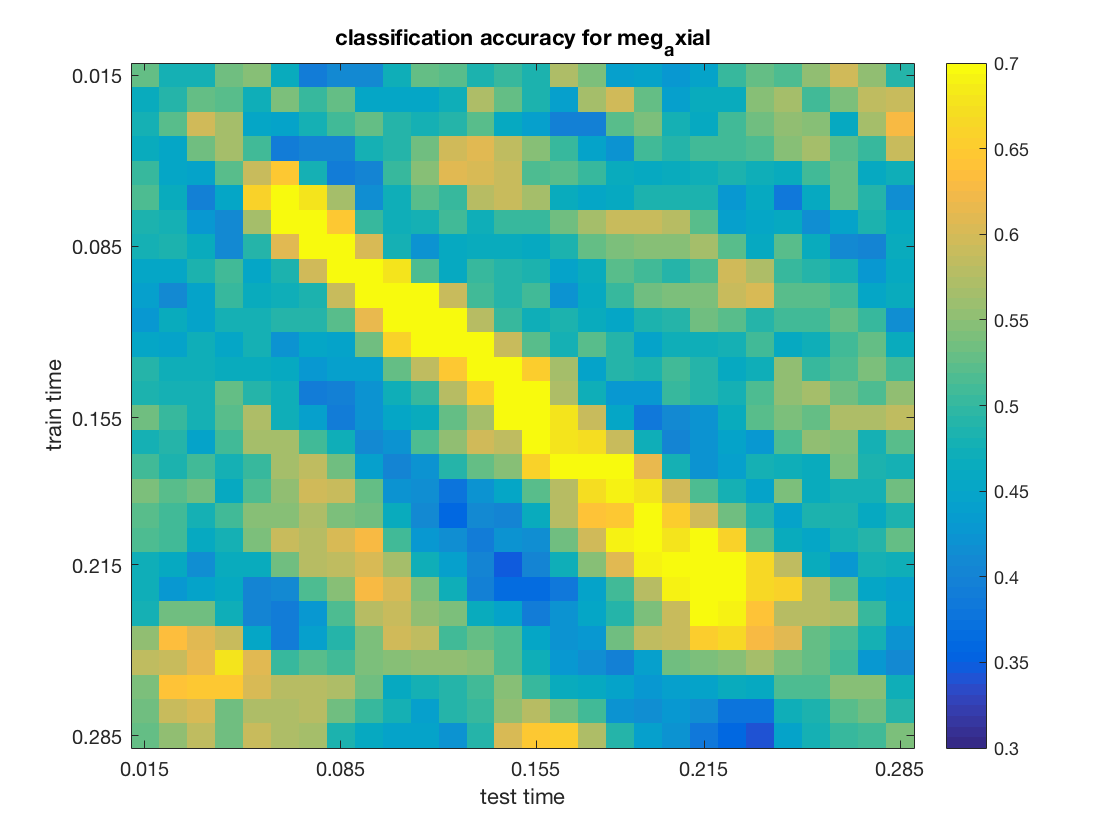 gallery_demo_meeg_timeseries_generalization_1