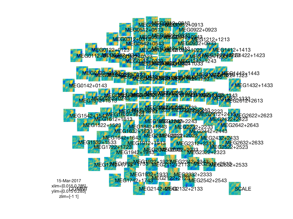 gallery_demo_meeg_timeseries_generalization_3